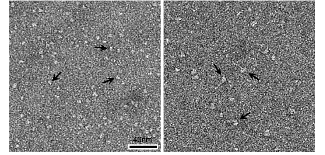 Main technical tool to visualize small complexed molecules (~ 100 kDa)