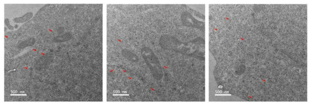 Qdot-streptactin을 활용한 MSC 검출의 immuno-EM 연구결과