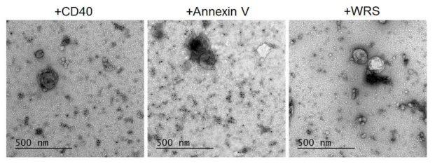 Immuno-negative staining 이미징을 활용한 WRS-containing ectosome 이미징 분석