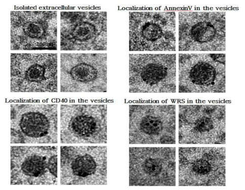 Immuno-EM을 통한 WRS의 Ectosome vesicle localization 분석