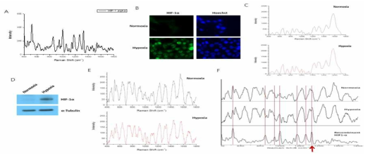 위암세포주의 HIF-1a 발현조건에서 라만 분석. (A) Recombinant HIF-1a 단백질 분석 (B) 저산소 환경에서 HCT116 세포의 HIF-1a 발현 (C) B 조건의 라만 분석 (D) 저산소 환경에서 HCT116 세포 추출물에서 HIF-1a 단백질 발현 (E) D 조건에서 라만 분석 (F) A와 E