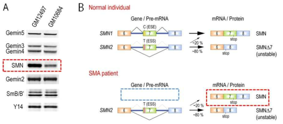 정상인과 척수성 근위축증 환자의 SMN 유전자 발현 (A) 척수성 근위축증 환자세포에는 SMN 단백질의 양이 정상세포에 비해서 현저히 감소되어 나타남. (B) 척수성 근위축증 환자는 SMN1 유전자가 결핍되어 있어서 (파란색 점선 사각형) SMN2 유전자에 의해서만 SMN 단백질을 공급받는데, SMN2로부터 만들어지는 대부분의 SMN단백질인 SMND7은 매우 불안정한 특징을 가짐. 결국 척수성 근위축증 환자에서는 소량의 정상적인 SMN 단백질만이 만들어짐 (붉은색 점선 사각형으로 표시됨)