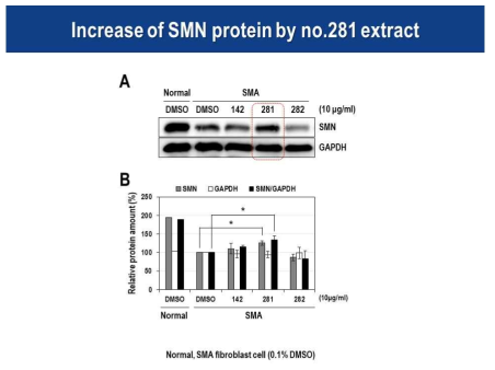 환자유래세포에서 확인된 3개 유효추출물에 의한 SMN 단백질 증가효과