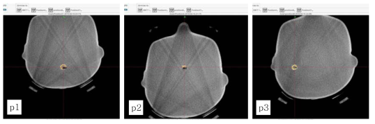 세 가지 다른 위치 (p1, p2, p3)에서 RSVP phantomTM 내 종양 모양 섬광체의 Cone beam computer tomography (CBCT) axial images. 각각 서로 다른 treatment planning을 수행했고 (파란색 선) 50%의 5Gy isodose의 처방 선량이 주어졌음 (노란색 선)