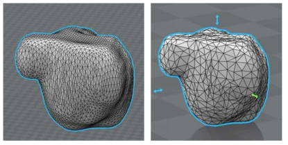 3D 종양 모델의 표면축소 기능을 적용하기 전(좌) 표면 축소 기능을 적용한 후(우)
