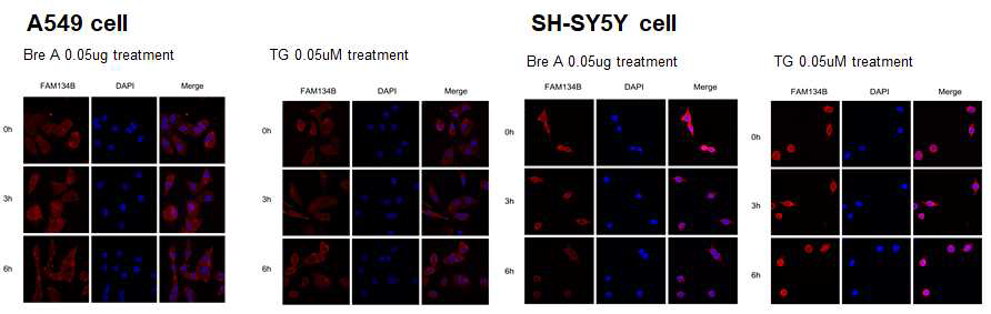 ER stress 유도제인 0.05ug의 Brefeldin A 및 0.05uM의 Thapsigargin을 처리하였을 때, 폐암세포 A549세포에 ER 자식작용 수용체인 FAM134B가 시간에 따라 발현이 증가함을 확인하였음. 하지만 신경세포인 SH-SY5Y 세포에서 endogenous한 ER 자식작용 수용체의 발현이 증가되지 않음을 확인함