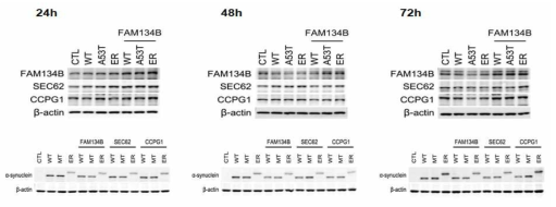 ER 자식작용 수용체 FAM134B-알파시누클린, SEC62-알파시누클린, CCPG1-알파시누클린의 동시 발현 세포모델의 확립