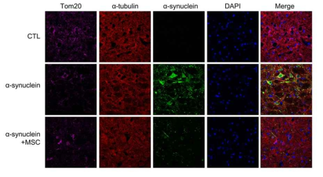 알파시누클린 과발현 실험동물에서 중간엽 줄기세포에 의한 tubulin 활성 및 알파시누클린의 감소 양상 관찰