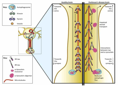정상 및 파킨슨병 뇌조직에서 알파시누클린 및 타우단백 의존 세포내 구조 수송과의 관계