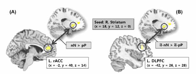 정서기억 변형에 대한 양가성 관련 기능적 뇌 연결성