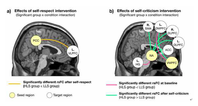 내재동기 관련 자기존중 및 자기비판의 뇌 영향