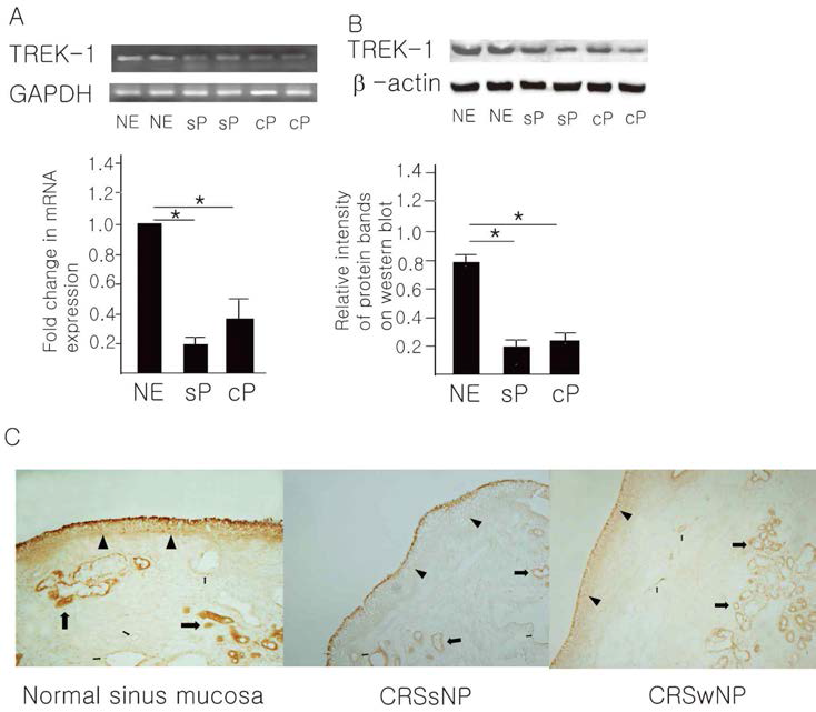 The expression levels of TREK-1 mRNA (A) and protein (B) in normal sinus mucosa of control subjects (NE; n=30) and inflammatory sinus mucosa of patients with CRSsNP (sP; n=30) and patients with CRSwNP (cP; n=30). Upper panel of figure A and B show representative data for RT-PCR and western blot respectively. * Significant difference in the expression levels of TREK-1 between normal and inflammatory sinus mucosa (P<.05). Results are expressed as means ± SDs. (C) Immunohistochemical localization of TREK-1 in normal and inflammatory sinus mucosa of patients with CRSsNP or CRSwNP. TREK-1 is distributed in the surface epithelium (arrow heads), submucosal glands (thick arrows), and vascular endothelium (thin arrows). Original magnification x 100