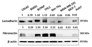 다양한 세포주 내 Fibronectin 및 Lactadherin의 단백 발현 확인