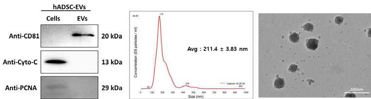 Western blot, NTA, TEM을 통한 EV의 분석