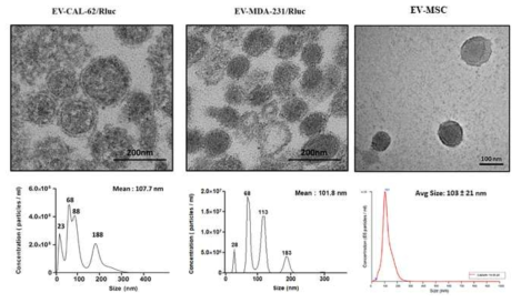 투과전자현미경 및 NTA를 통한 EV의 형태적 분석