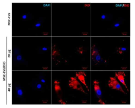DiD 표지를 이용한 EV의 세포 내 섭취 평가