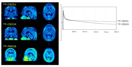 정상 성인 환자에서 뇌신경염증 후보 물질들을 이용한 PET영상 촬영. 후보 물질 중 신규 CB 계열의 화합물이 배경 섭취가 낮고, 뇌 내의 영역 해상도가 높음