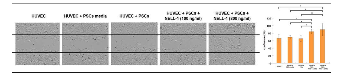 NELL-1 + PSCs increased HUVEC migration. PSCs 단독으로는 cell migration을 증가시키지 못함. 하지만 NELL-1과 PSCs를 같이 사용하였을 때, cell migration이 증가함