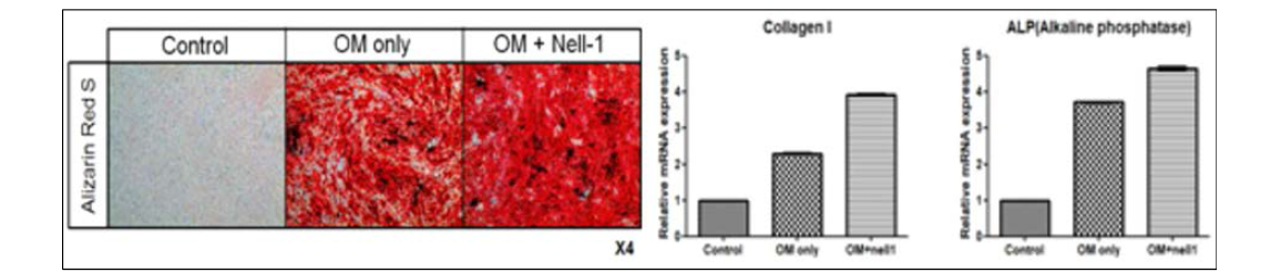 Pro-osteogenic effect of NELL-1