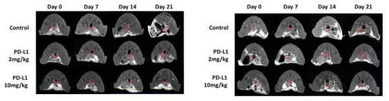 면역 관문 억제제 투여 후 항암 효능의 확인 (좌) PD-L1 발현되는 MC38의 경우 항암 효능이 잘 나타나는 것이 보임 (우) PD-L1 발현이 적은 CT26의 경우 항암 효능이 잘 나타나지 않음