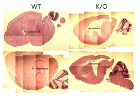 시상면 기준 조직학적 분석 결과. LRRC50 녹아웃 생쥐의 경우 3 뇌실(3rd ventricle)이 확장됨