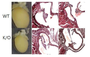 LRRC50 녹아웃 마우스에서의 심장 크기 변화 및 판막이형성