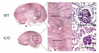 LRRC50 녹아웃 마우스에서 나타난 신장과 사구체 크기의 감소 및 budding의 방향성 변화
