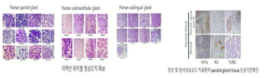 방사능 기인 사람 타액선 세포손상 확인