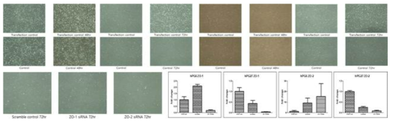 타액선 도관세포의 최적의 transfection 방법확립 및 ZO-1,ZO-2 siRNA 처리에 따른 유전자발현 변화 및 세포증식 변화 확인