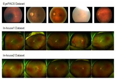 EyePACS, In-house1, In-house2 데이터 세트 영상 샘플