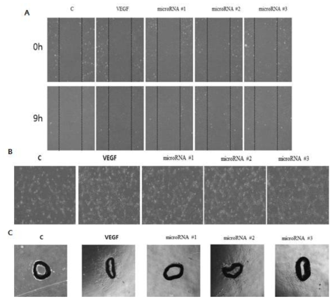 in vitro 및 ex vivo functional assay. A. in vitro endothelial cell wound healing migration assay, B. in vitro endothelial cell tube forming angiogenesis assay, C. ex vivo aorta ring assay