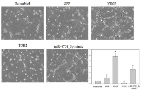 exosomal mir 4701-TOB2 유전자 발현조절에 의하여 혈관신생성이 조절 된다는 것을 확인함. (Tube forming assay)