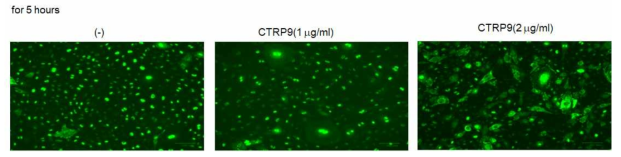 mir 4701-CRRP9에 의한 HDAC5의 세포내 핵에서 세포질로의 이동을 확인함