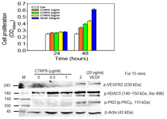 mir 4701-CRRP9에 의한 PKD-HDAC5 신호기작이 활성화되는 것을 확인함