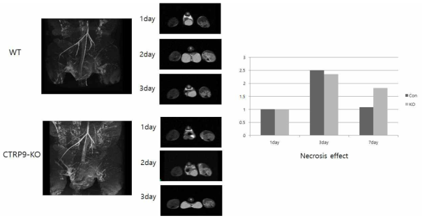 혈관신생성 질환모델인 Hindlimb ligation assay