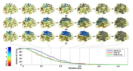 ADHD, ASD, 및 정상소아군에서의 Persistent homology 통한 뇌 연결망 비교