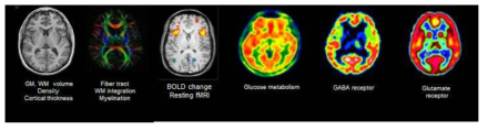 네트워크 분석법에 적용 가능한 다양한 종류의 뇌 영상