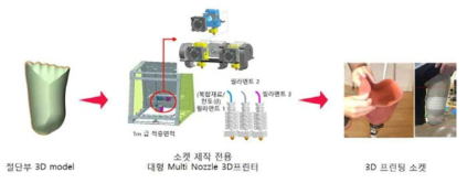 3D 프린팅 기반의 사용자 맞춤형 소켓 개발 개요도