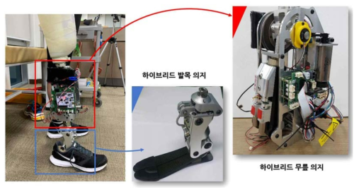 Hybrid Knee/Ankle Prosthesis