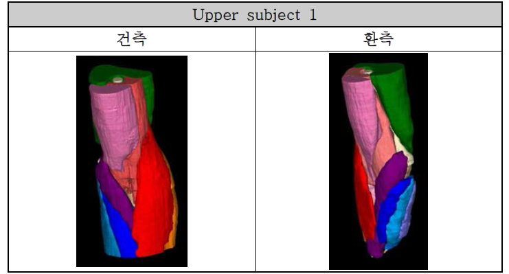 전동의수 사용자의 3-Demensional Reconstruction Model