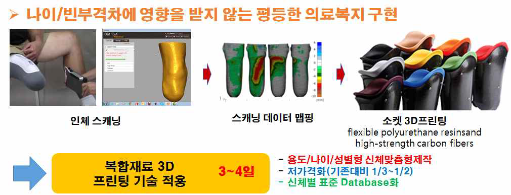 3D프린팅 기술 활용 소켓 제작 기법