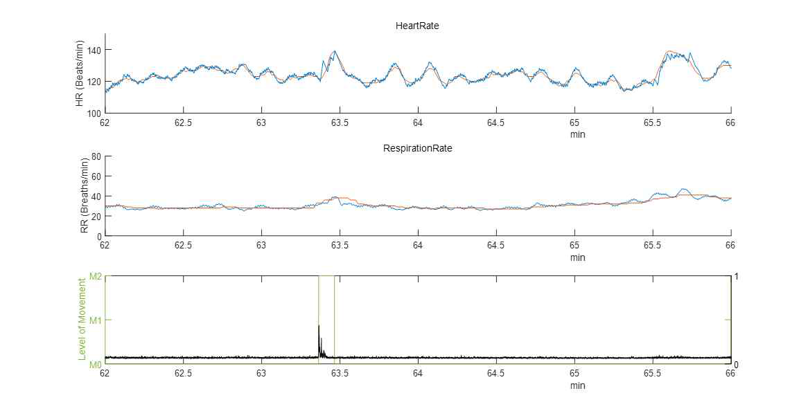 Conventional Patient Monitor와 IR-UWB Sensor의 호흡수와 심박수 비교