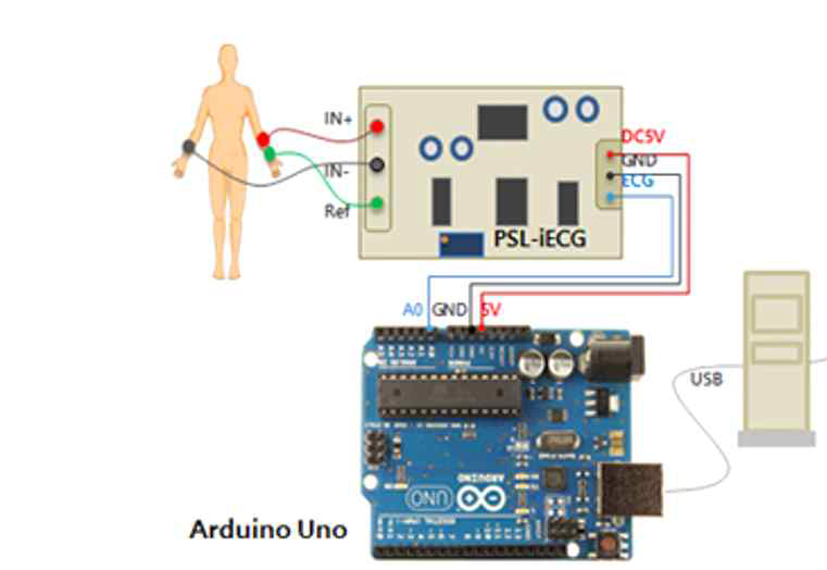 ECG 모듈, 아두이노, 컴퓨터의 연결도