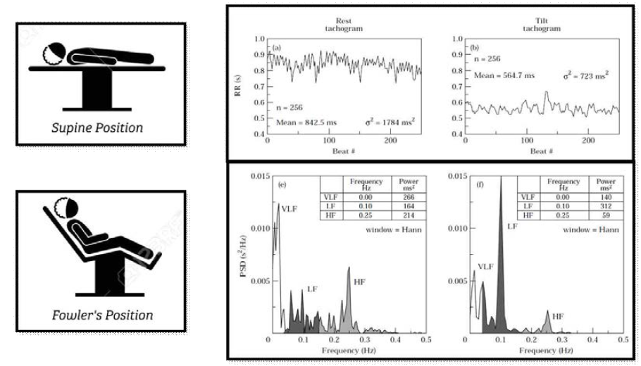 자세에 따른 HRV 변화 Tachogram 및 Power Spectral Density