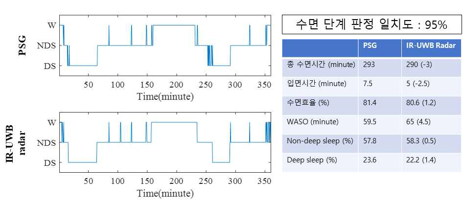 수면다원검사와 수면단계 판정 결과 비교