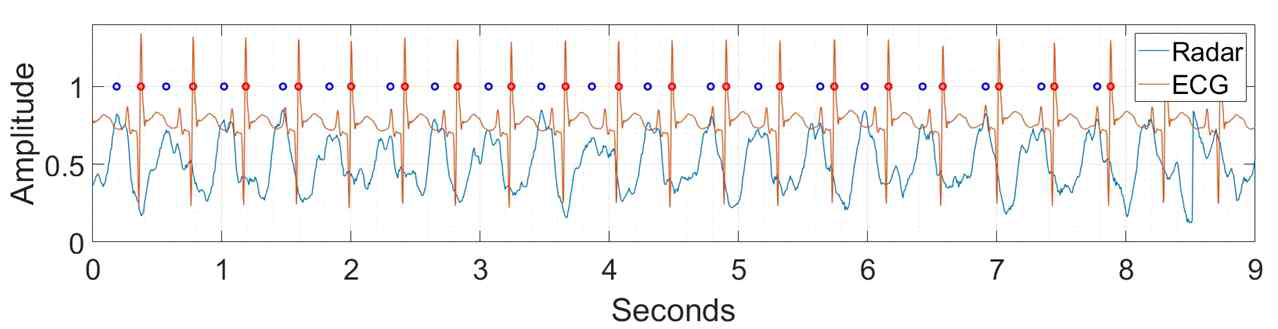 ECG와 레이더 신호로 측정한 심박