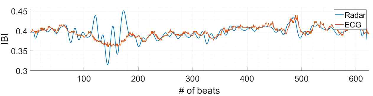 ECG와 레이더 신호로 측정한 HRV