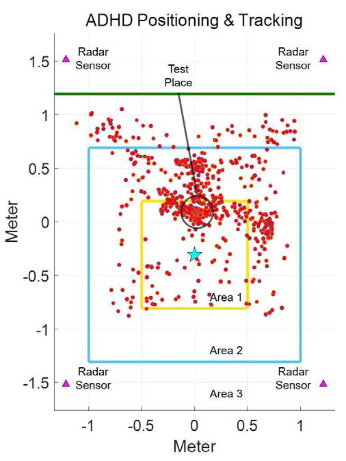 Positioning of Patient by four IR-UWB Radar