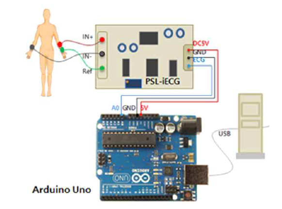 ECG 모듈, 아두이노, 컴퓨터의 연결도