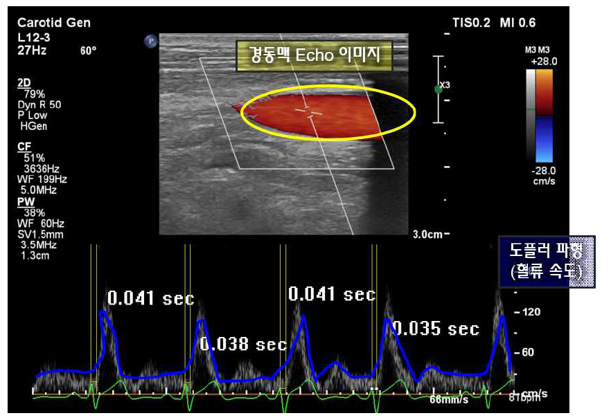 초음파 장비로 측정한 심박 Doppler 및 ECG